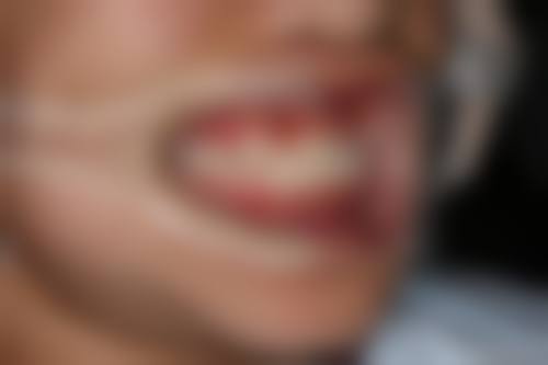 聂向真医生技术优势