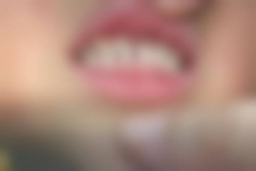 聂向真医生项目收费价格