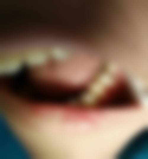 宁波金诺口腔预约挂号方式