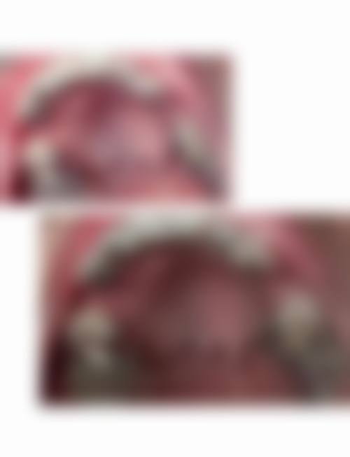 王梅芝医生项目收费价格