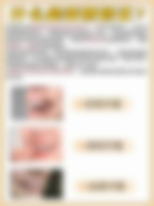 宋剑玮医生项目收费价格