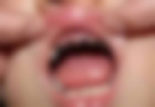 冯波医生技术优势