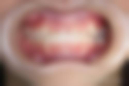 宋剑玮医生技术优势