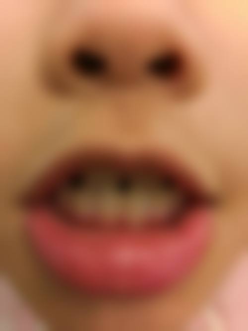 聂向真医生口碑评价及反馈内容