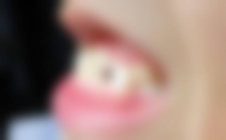 刘代斌医生项目收费价格