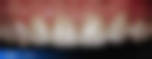 赵莹琼医生技术优势