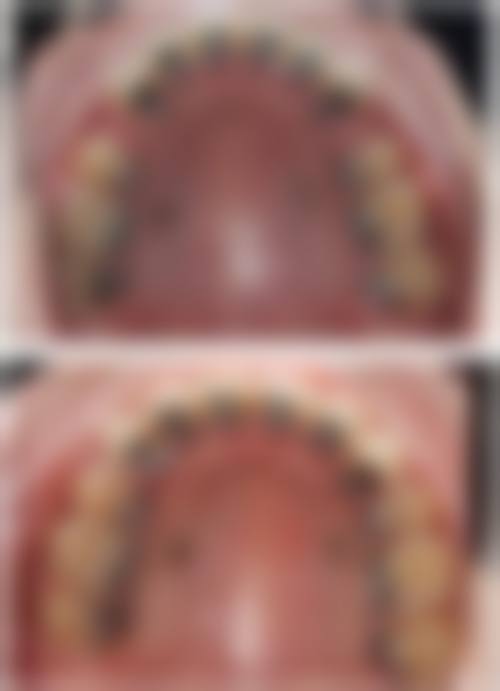 王梅芝医生技术优势