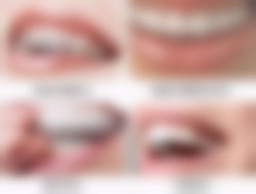 金华贝佳口腔诊所特色诊疗项目与技术优势