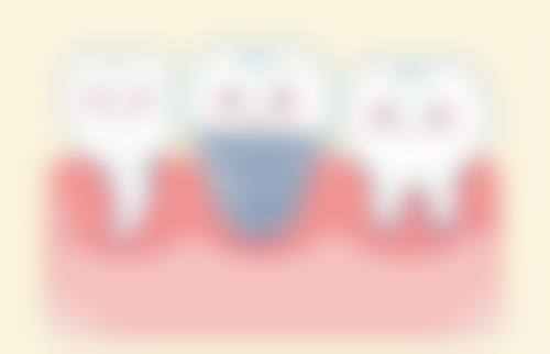 苏艳国医生技术优势