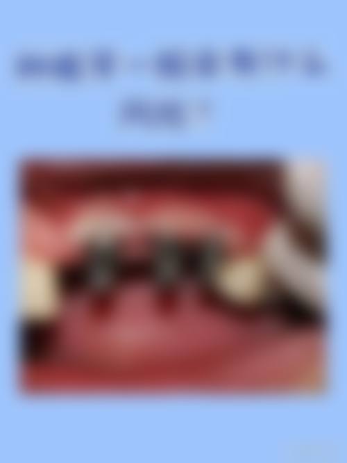 衡阳石鼓爱齿牙科诊所预约挂号方式