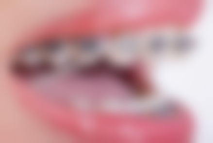 高蕊医生技术优势