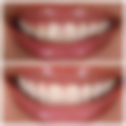 牛薇医生项目收费价格