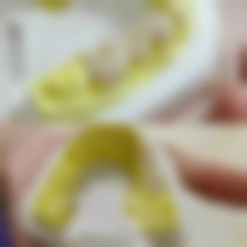 陈代远医生项目收费价格