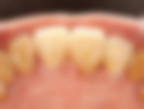 李海帆医生技术优势