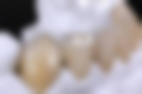 张家界市中医院刘代斌医生技术优势