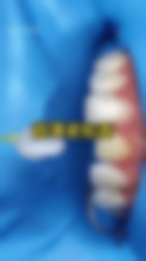 李海帆医生项目收费价格