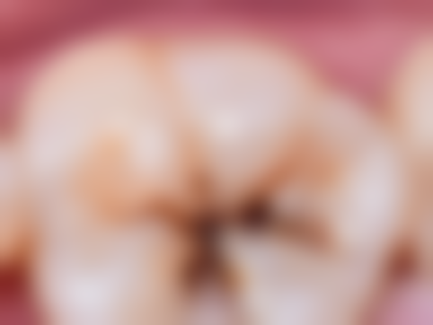 李袁医生技术优势