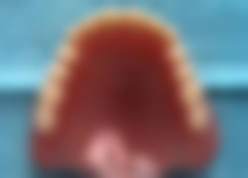 冯波医生项目收费价格