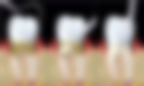 王文清医生项目收费价格