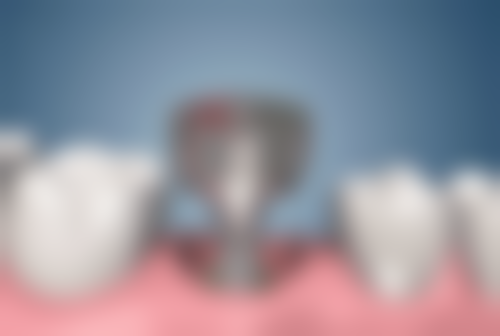 山东潍坊韩国启口腔收费价格表