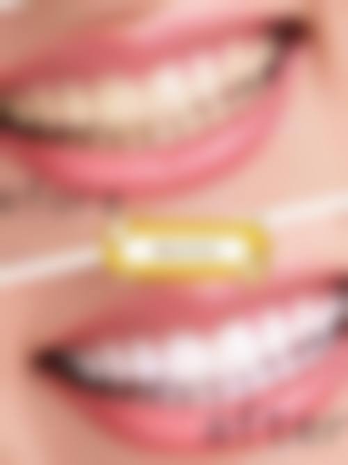 大连世康口腔诊所收费价格表