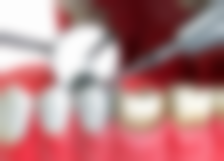 冯波医生技术优势