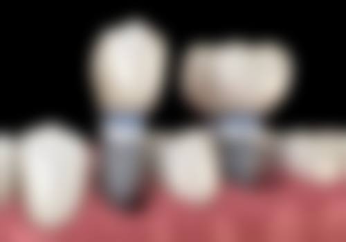 云南博泰口腔医院收费价格表