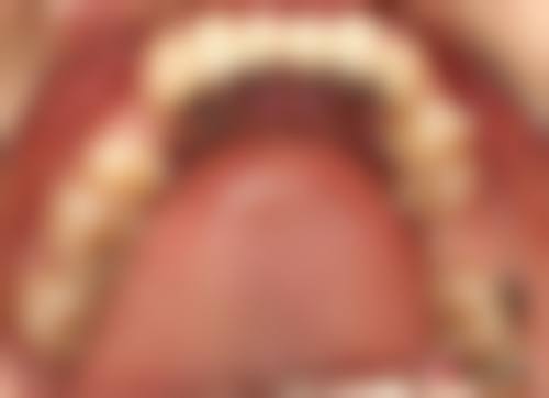 王梅芝医生技术优势