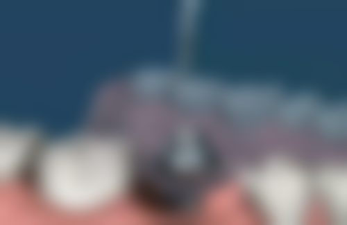 惠州致美口腔（江北分院）医生团队介绍