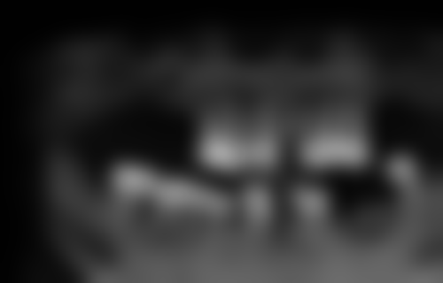 湖南张家界小牙匠口腔（夏小叶诊所）收费价格表