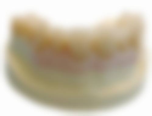 赵莹琼医生项目收费价格