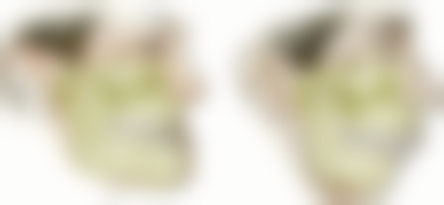 杭州口腔医院建德分院预约挂号方式