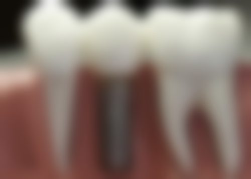 上海拜博口腔（奥华店）收费价格表