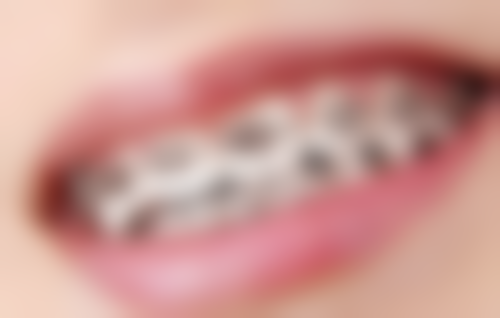 闫绍华医生项目收费价格