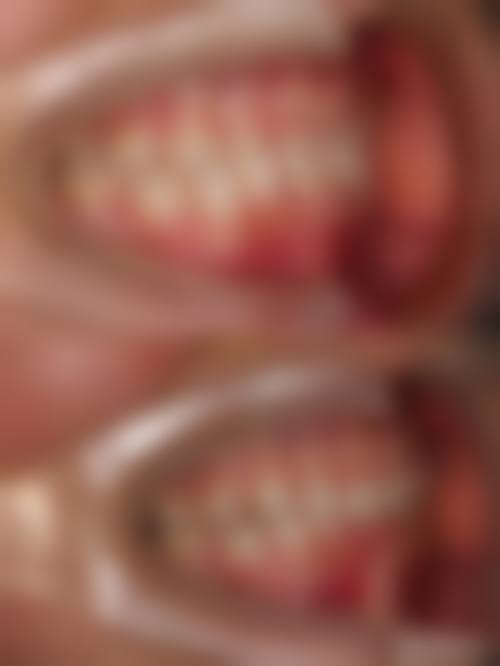 宋剑玮医生技术优势