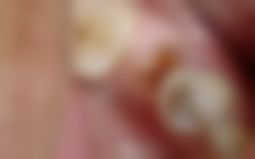 溧阳瀚雅口腔门诊部预约挂号方式