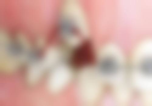 番禺熊阜飞口腔医生团队介绍