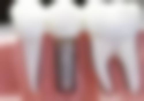 广东佛山中益口腔门诊特色诊疗项目与技术优势