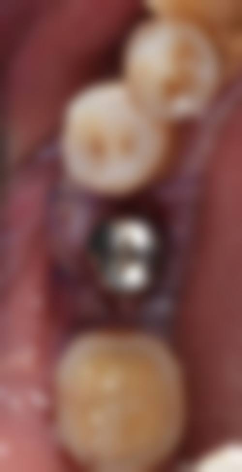 广东东莞南城铭医口腔门诊部收费价格表