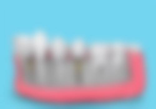 重庆开州区一诺口腔收费价格表