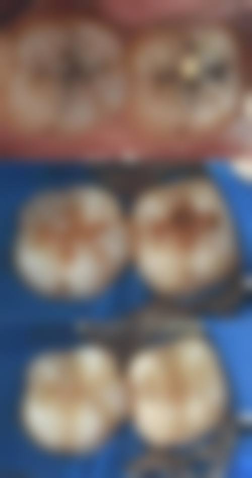 重庆开州区一诺口腔预约挂号方式