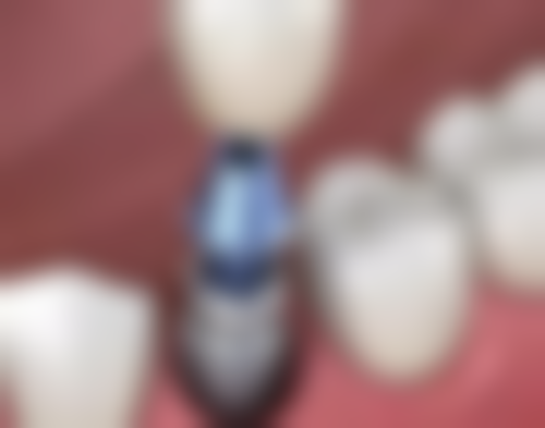 信阳华瑞口腔医院门诊部收费价格表