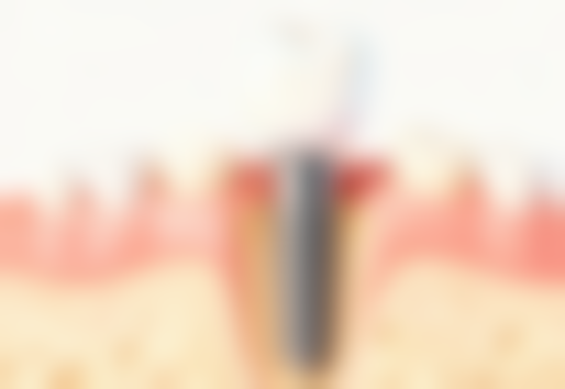 武汉爱尚大众口腔青年路门诊部收费价格表