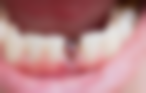 王一宁医生口碑评价及反馈内容