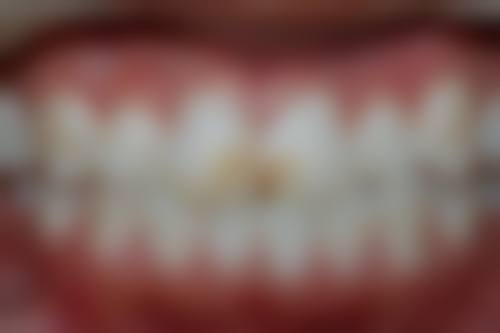 闫绍华医生技术优势