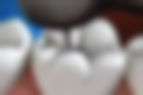 福建泉州晋江西园义博口腔特色诊疗项目与技术优势