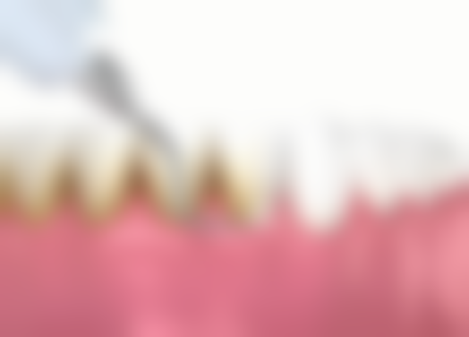 闫绍华医生项目收费价格