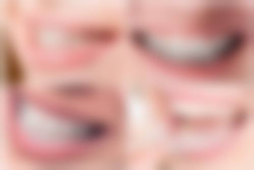 严凤（保定市妇幼保健院）医生项目收费价格