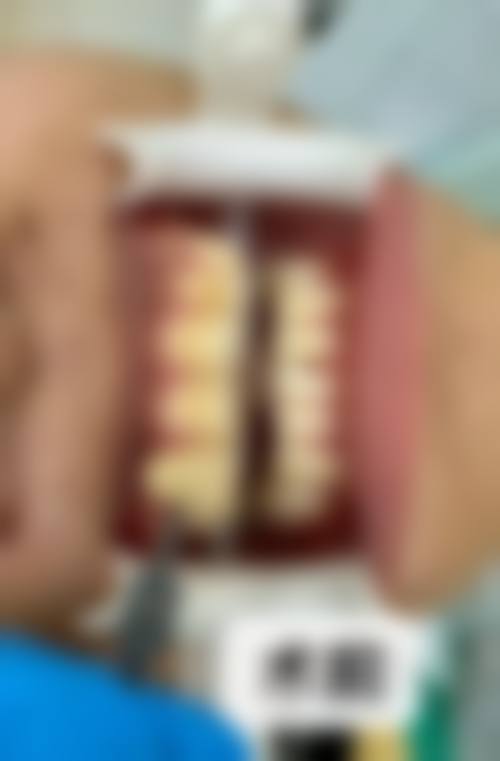 贵阳富林口腔预约挂号方式