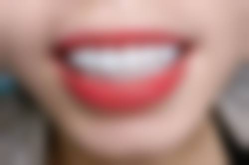 昆明鲲鹏口腔收费价格表